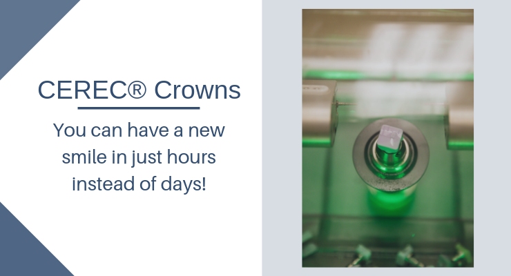 CEREC Crowns - You can have a new smile in just hours instead of days!