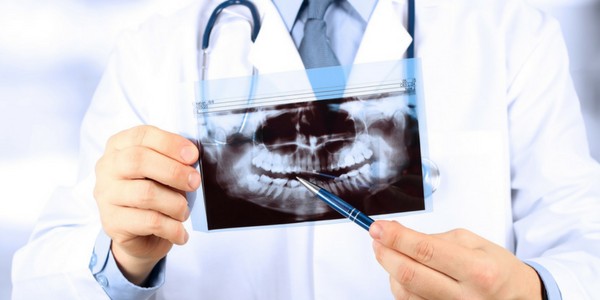 Many wonder are dental x-rays safe?