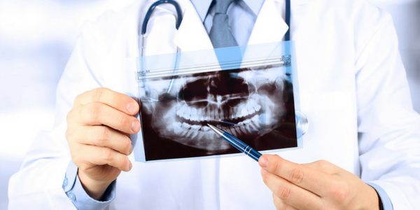 Many wonder are dental x-rays safe?
